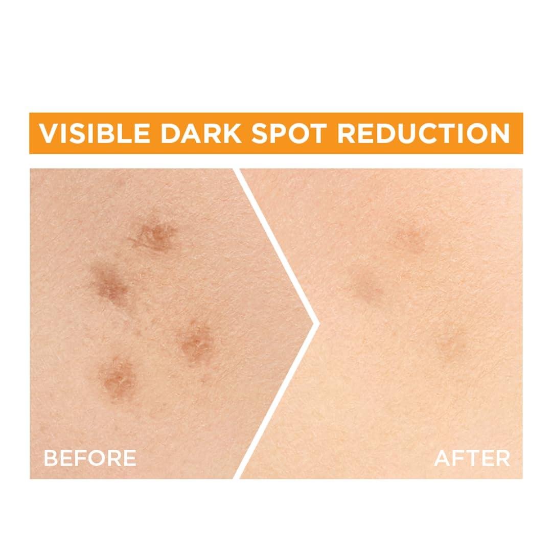 Garnier ‍Vitamin C ‍Serum: Our Brightening Journey
