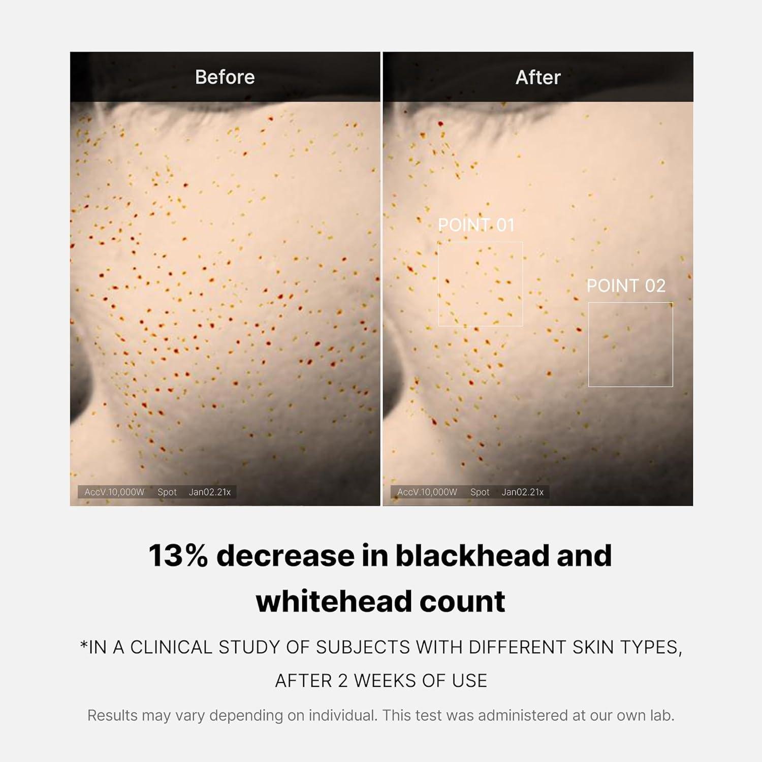 We Shrank ​Our pores⁣ Overnight: Medicube's Magic‌ Elixir