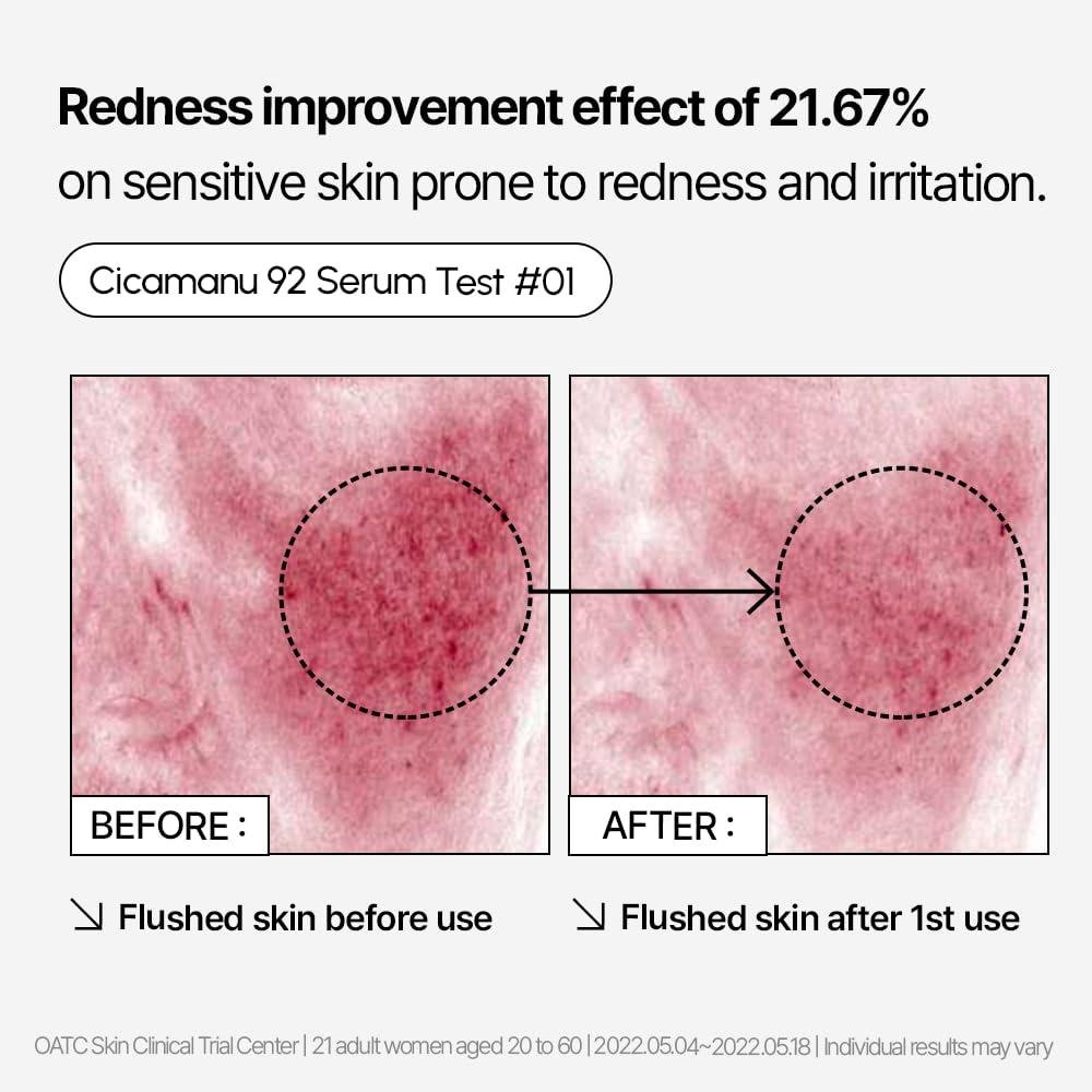 Our Dreamy Discovery:⁢ Parnell's Cicamanu 92 Skin Savior