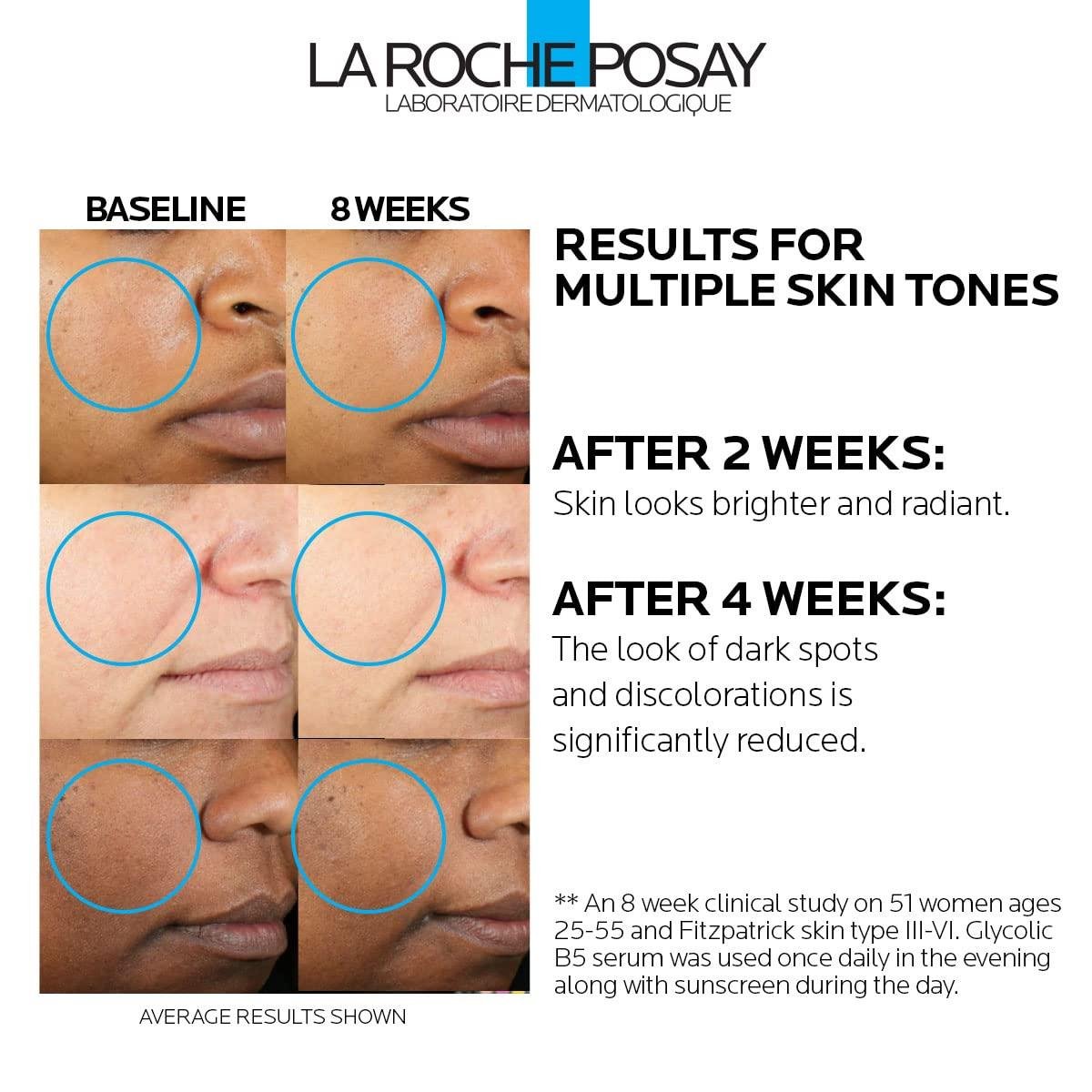 Our Journey with ⁢La Roche-Posay's Spot-Fighting⁢ Serum