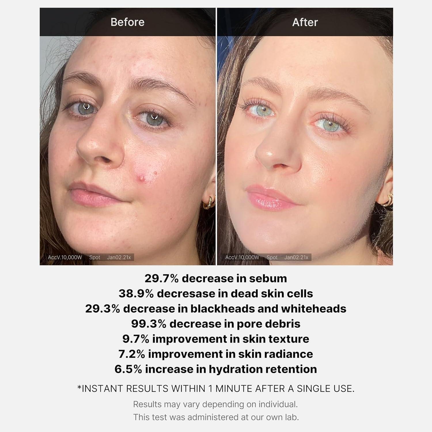 we Tried It: Medicube's ⁢Acid Wizardry for Bumpy ​Skin
