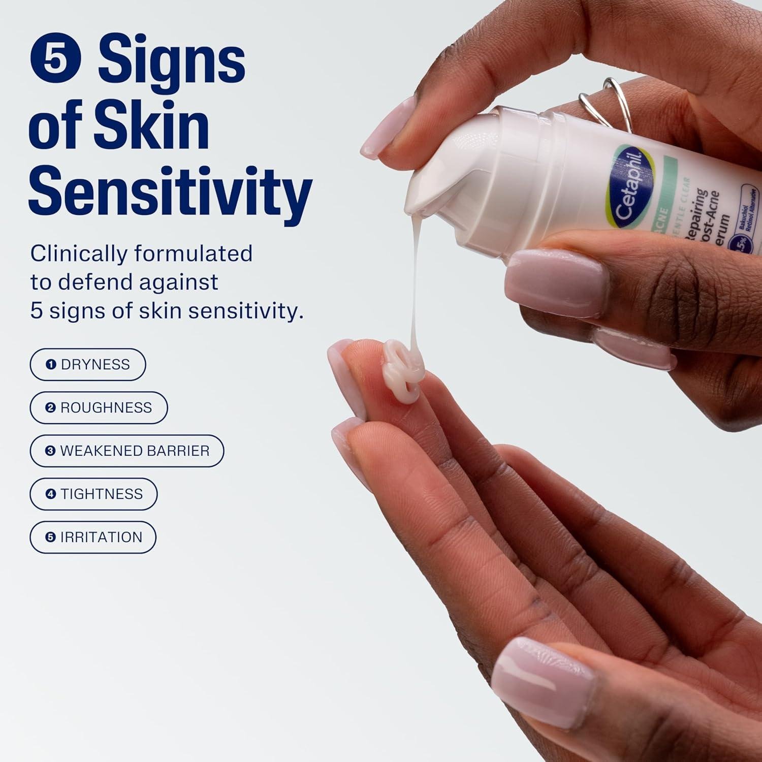 Unveiling Our Post-Acne Glow-Up: CETAPHIL's Bakuchiol Magic