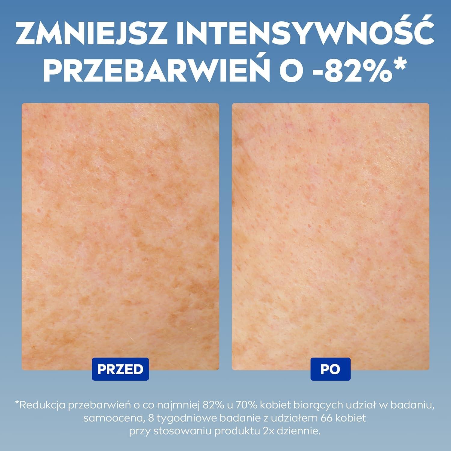 Unveiling Our⁤ Journey to Spotless Radiance with ‌NIVEA