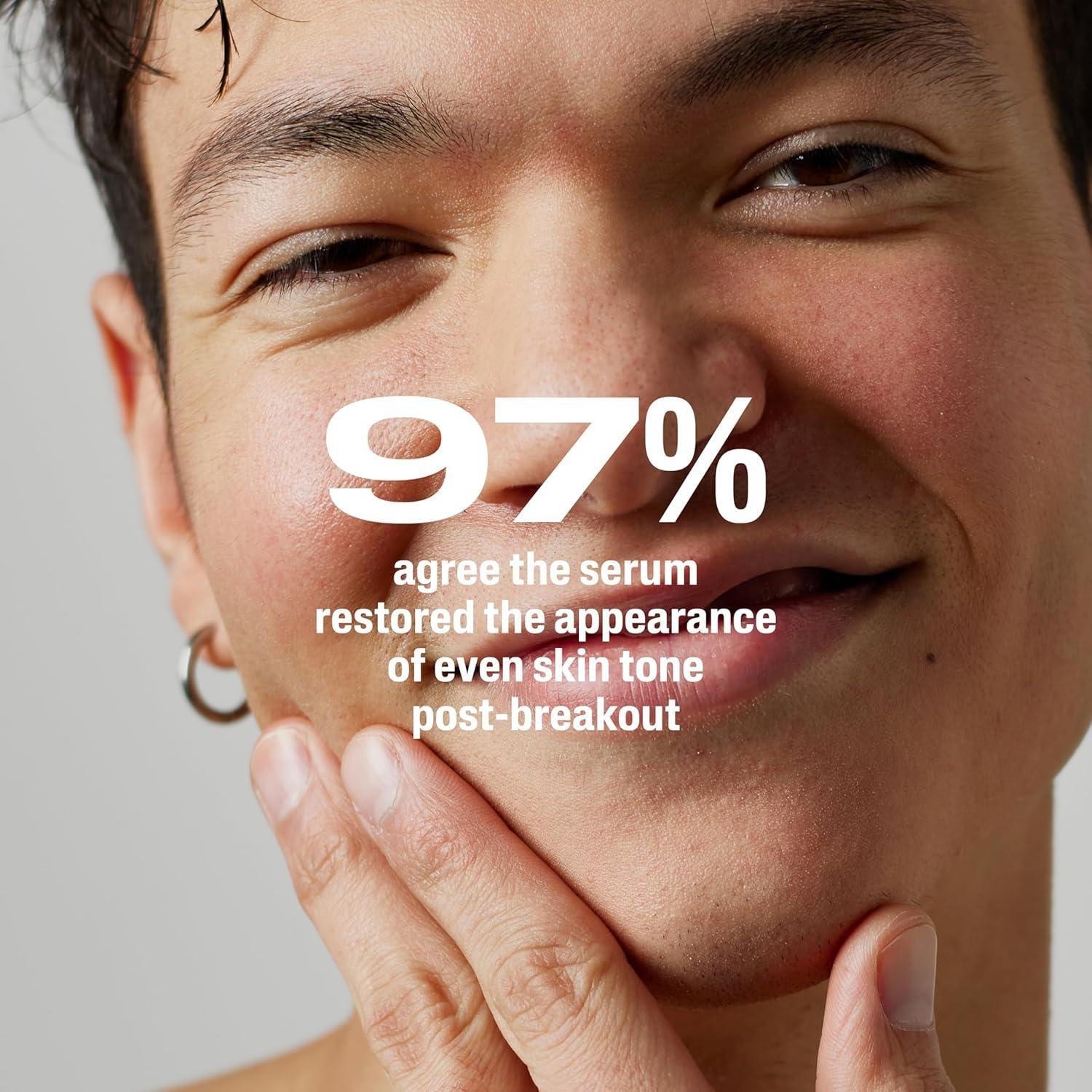 Unveiling Our‌ post-Acne Glow-Up: CETAPHIL's Bakuchiol‌ Magic