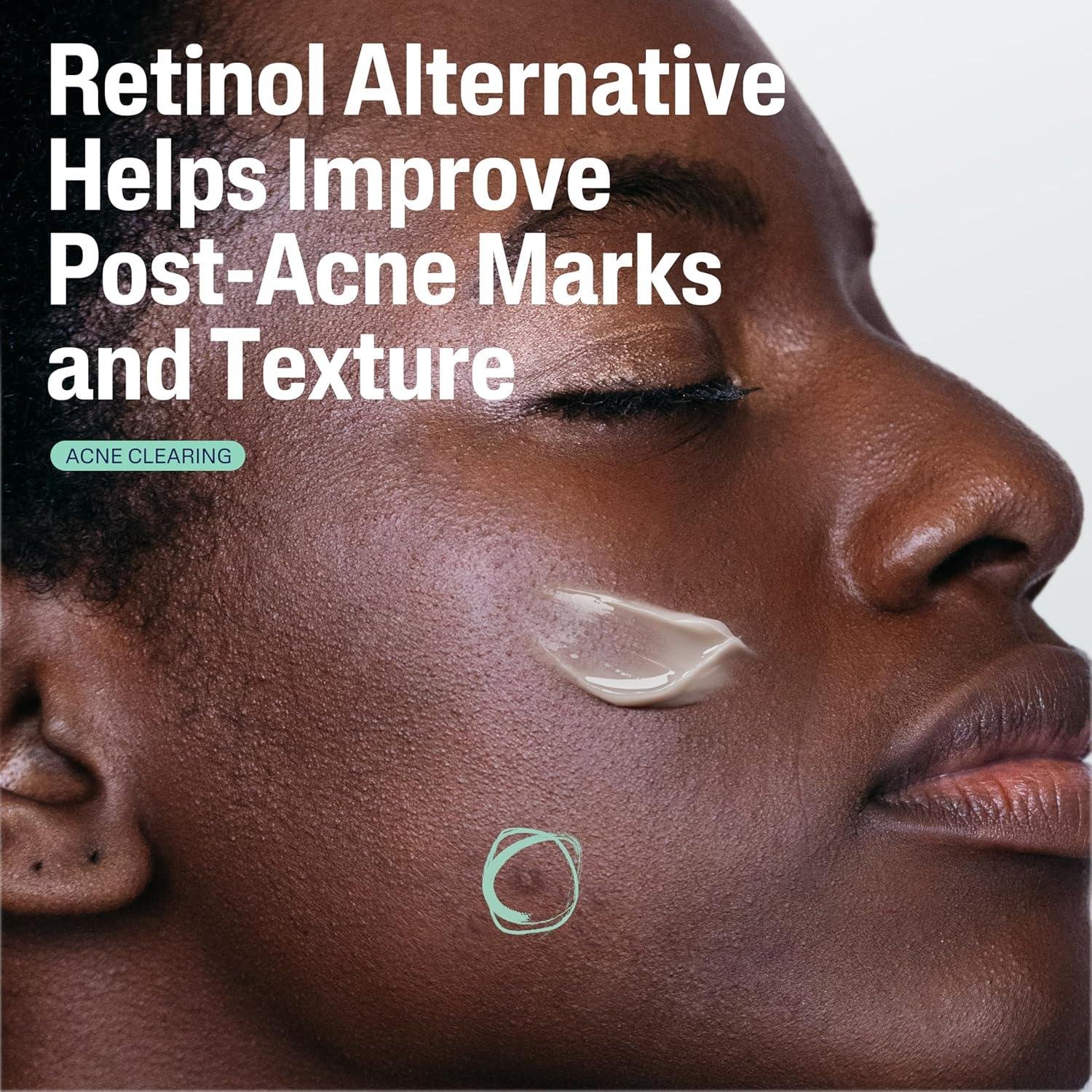 Unveiling Our Post-Acne Glow-Up: CETAPHIL's Bakuchiol Magic