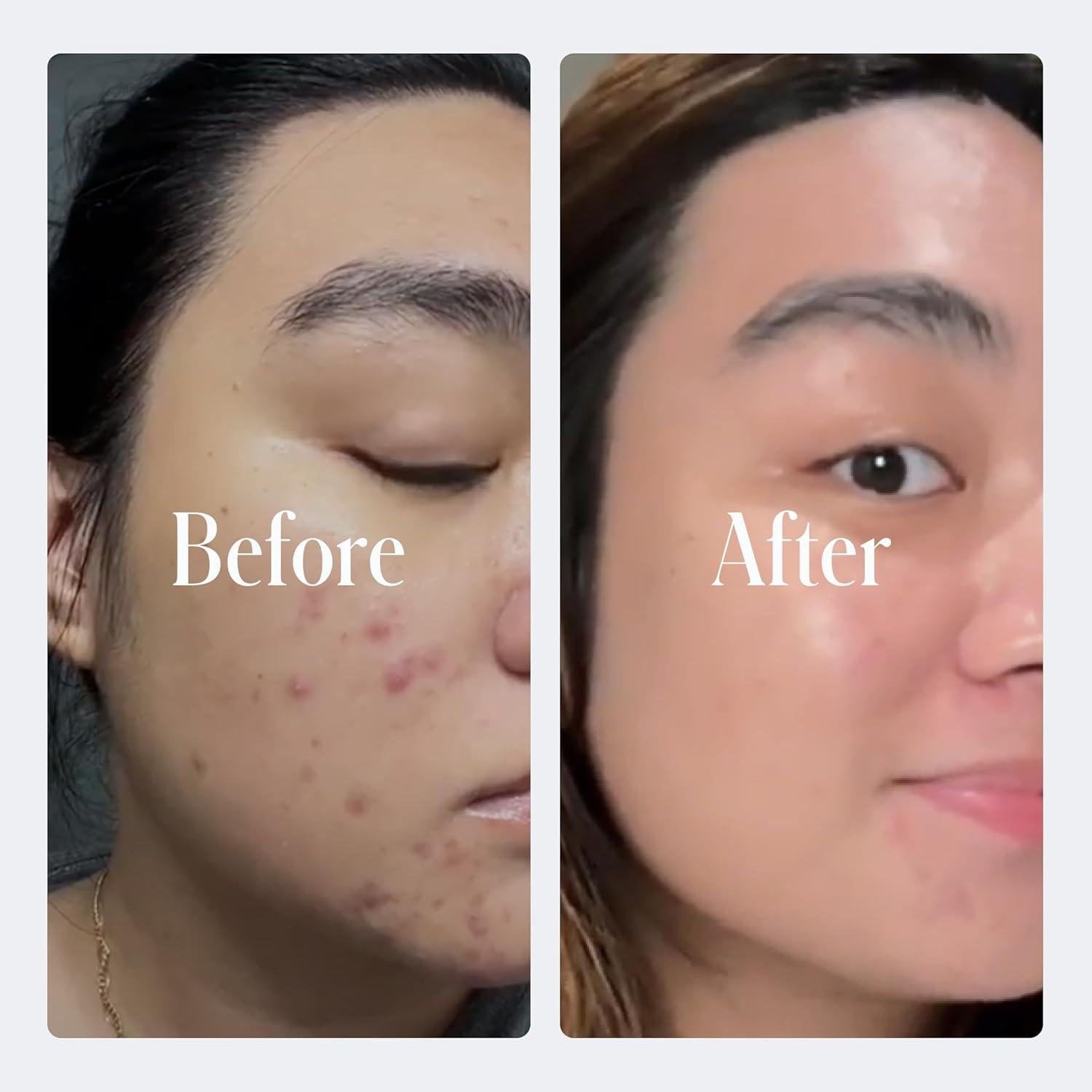 Our 90-Day Journey with Geologie's Sensitive Skin Set