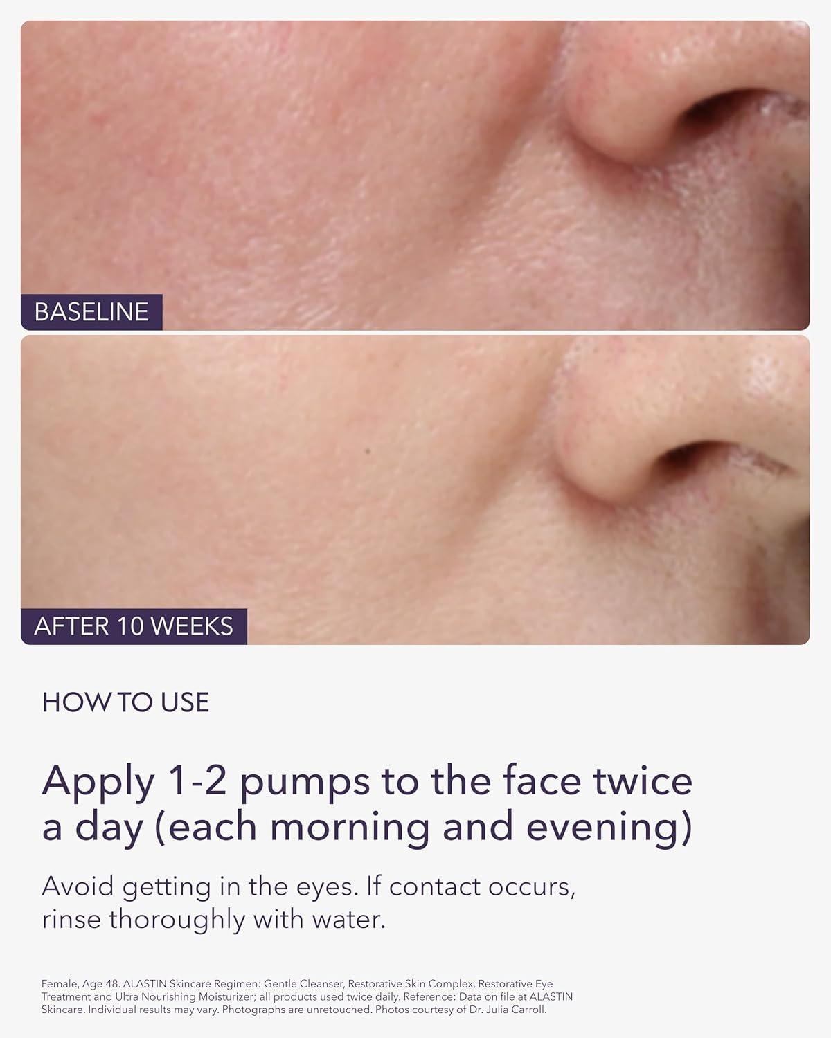 Our Review: ⁣ALASTIN Restorative Serum for Aging Skin