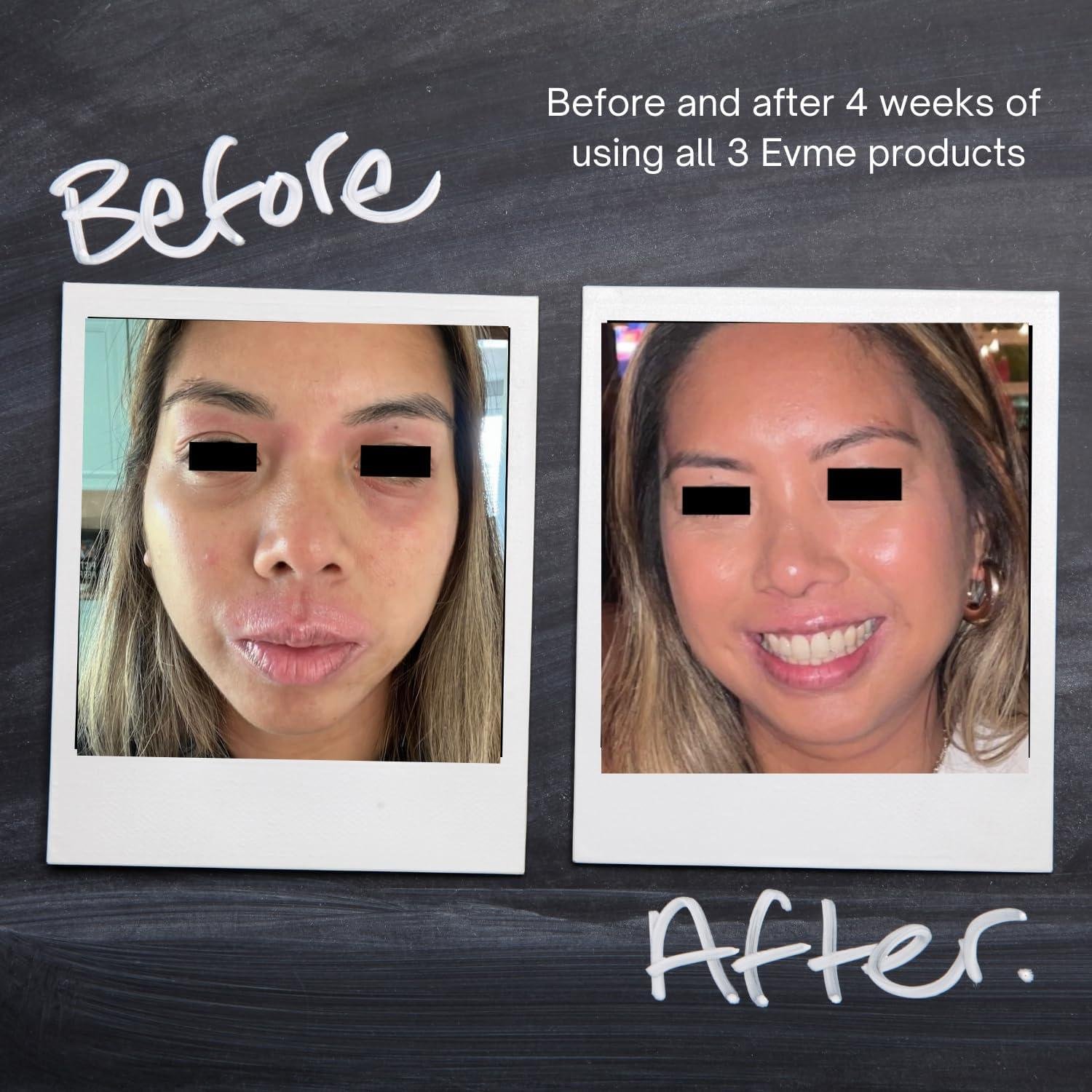 Reviewing Evme: ⁢Our Experience with ⁣Sensitive‍ Skin's New Best Friend