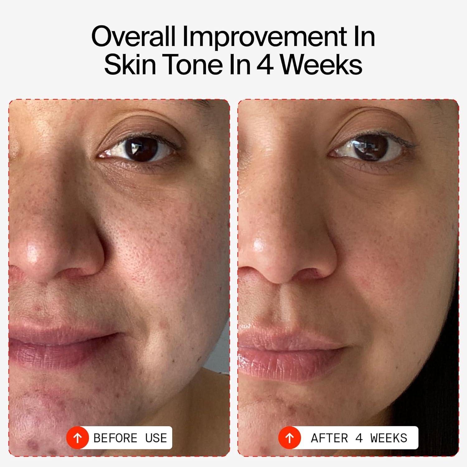 Revitalizing Our Skin: YTTP's Vitamin C ⁣Elixir