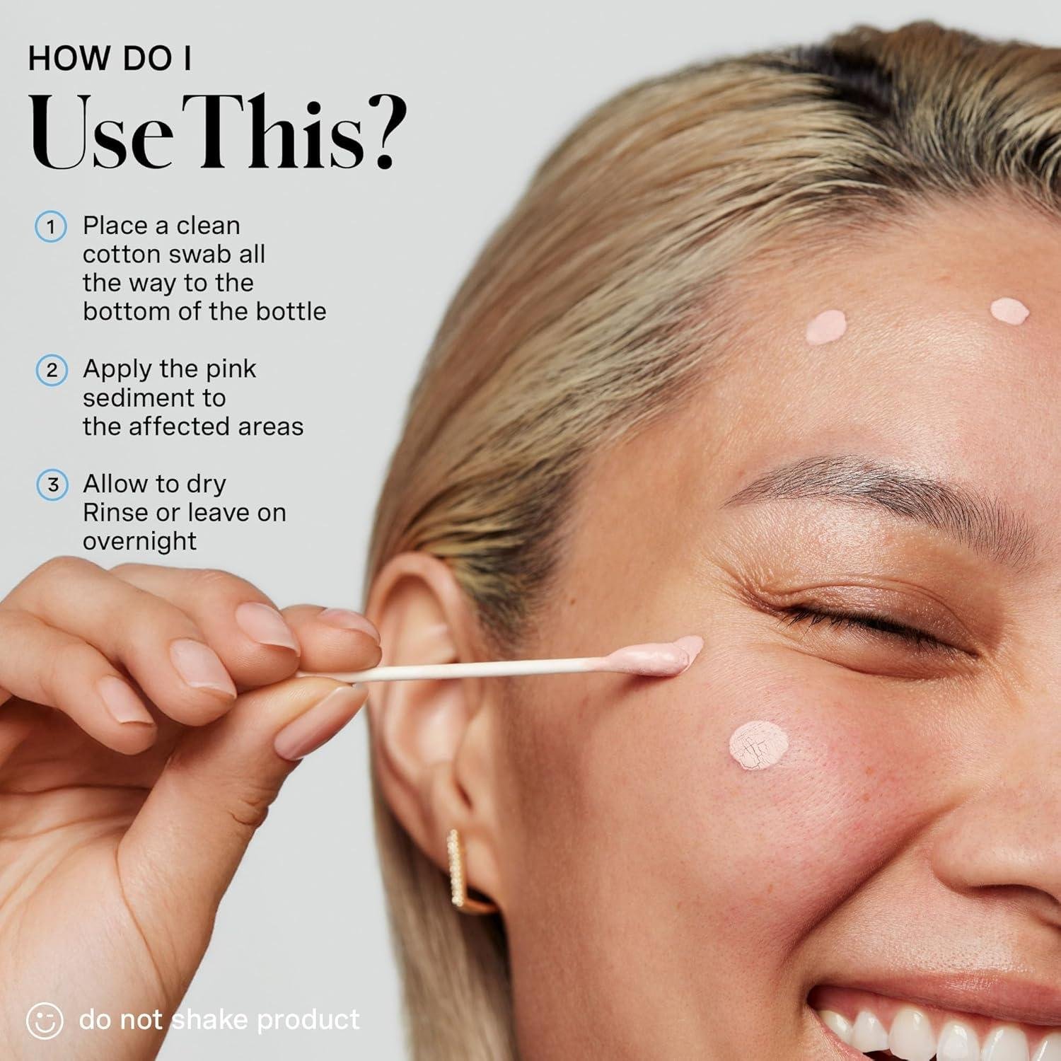 We‌ Uncovered Kate's Secret: Zapping Zits⁤ in a⁣ Flash