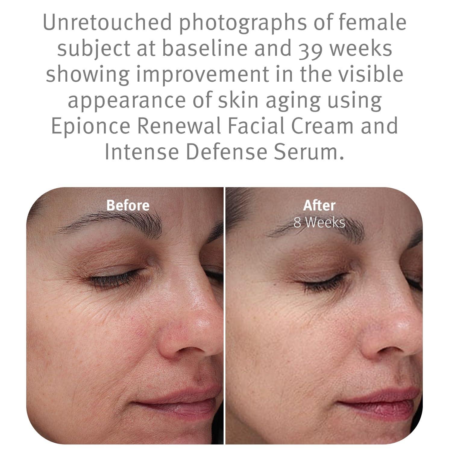 Nuestra Reseña: Epionce Renewal Cream para Piel Seca