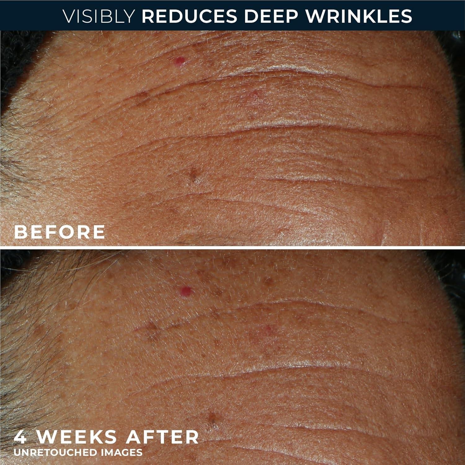 Our Dance with Time: RoC's retinol Magic Unveiled