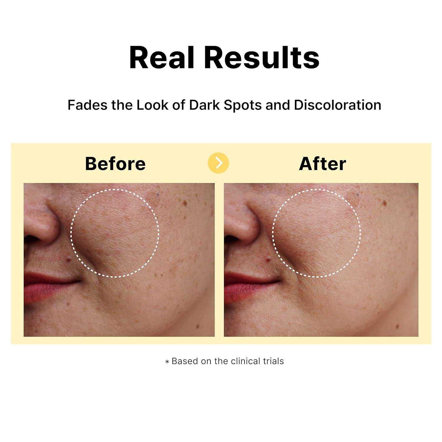 Unveiling Radiance: Our Journey with DearMYDEW's Spot-Erasing elixir