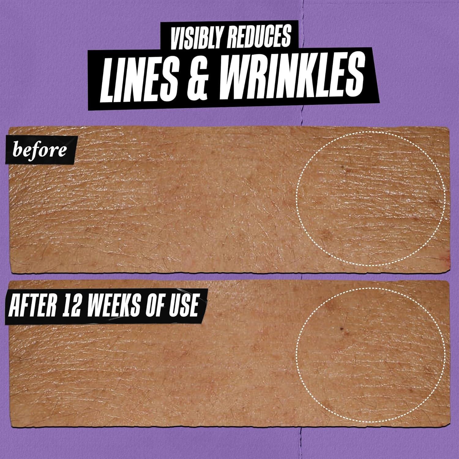 We Tested Kiehl's Micro-Dose Retinol: Age Defier?