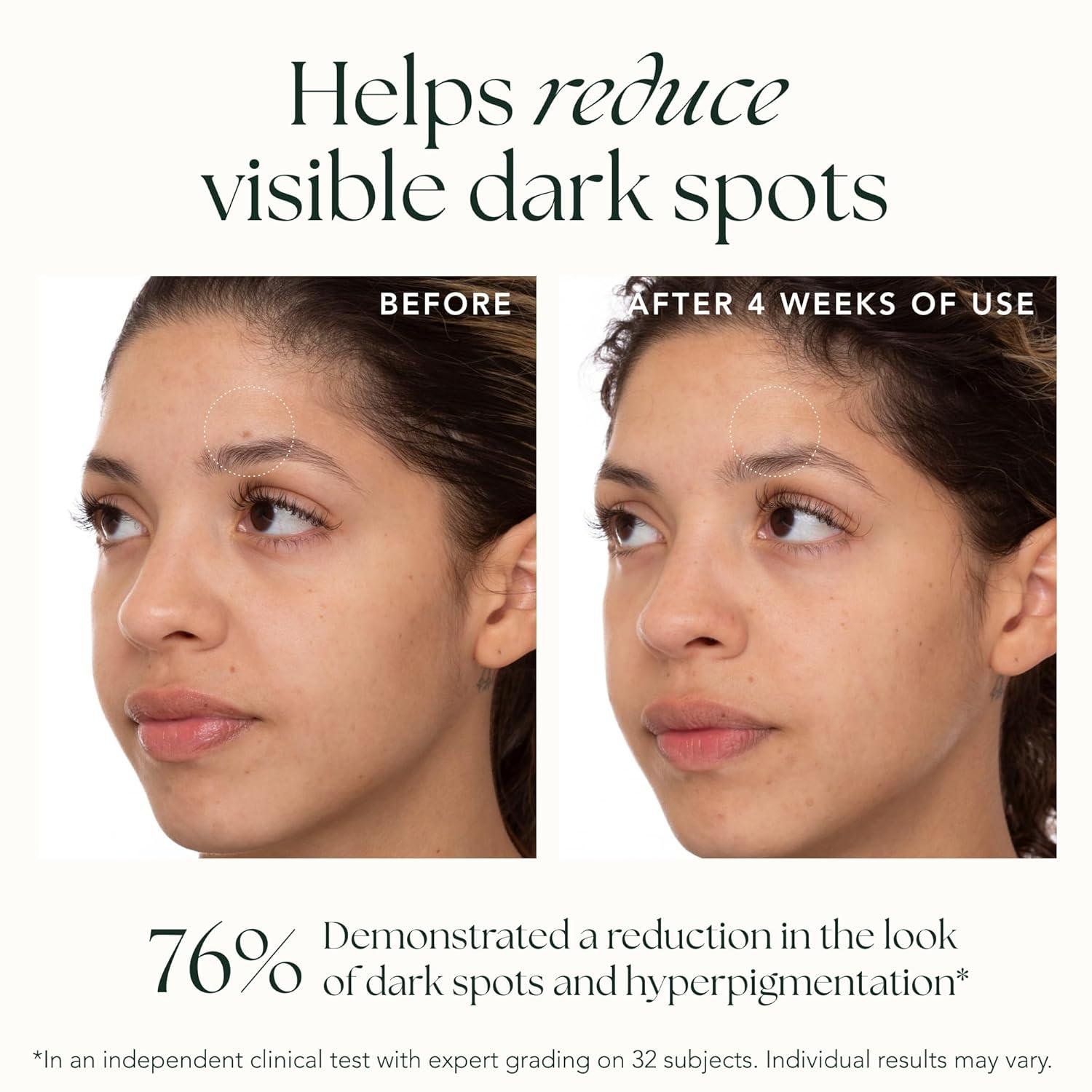 Saffron Glow: Our Journey with the Golden Elixir