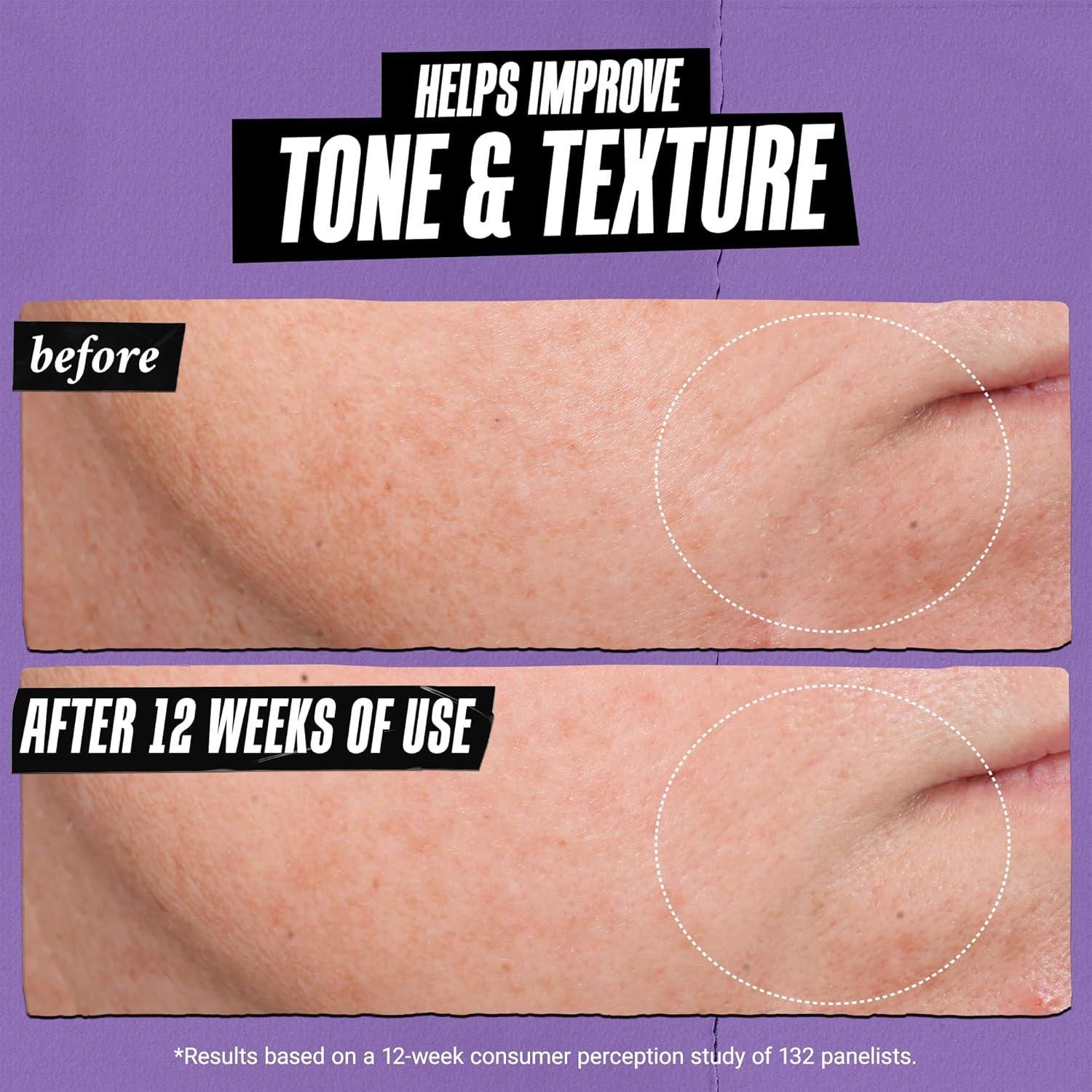 We Tested Kiehl's Micro-Dose Retinol: Age Defier?