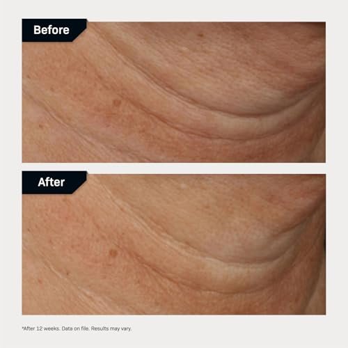 Revision Nectifirm Advanced: Peptide Neck Cream for Firming Aging Skin - Image 5