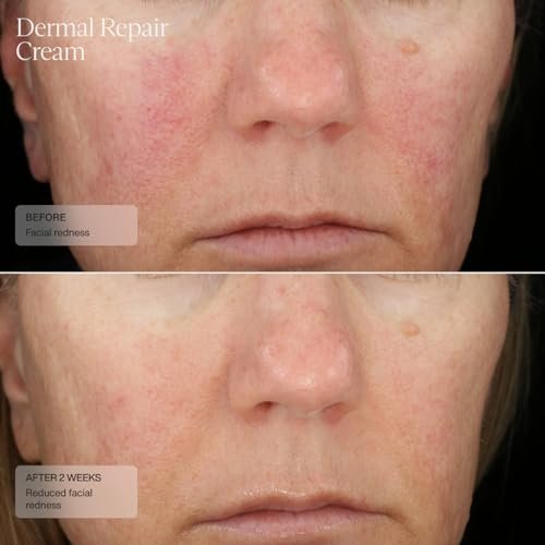 Senté Repair Cream: Rosacea Relief Hydrating Anti-Aging Facial Moisturizer - Image 6
