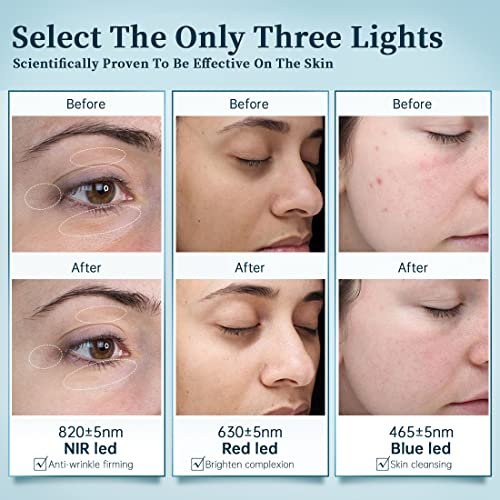 Professional LED Phototherapy Mask: Red & Blue Light Skin Rejuvenation Treatment - Image 5