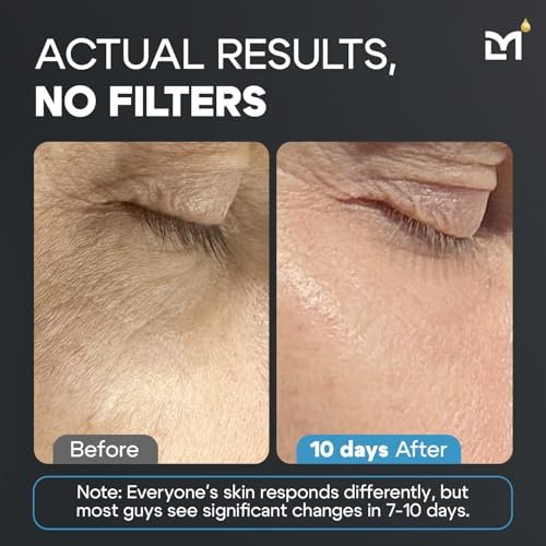 Mens Anti-Aging Skincare Set | Vitamin C Serum for Dark Spots & Wrinkles - Image 6