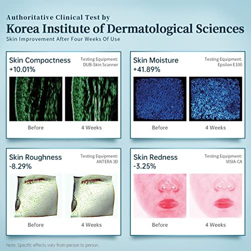 Professional LED Phototherapy Mask: Red & Blue Light Skin Rejuvenation Treatment - Image 6