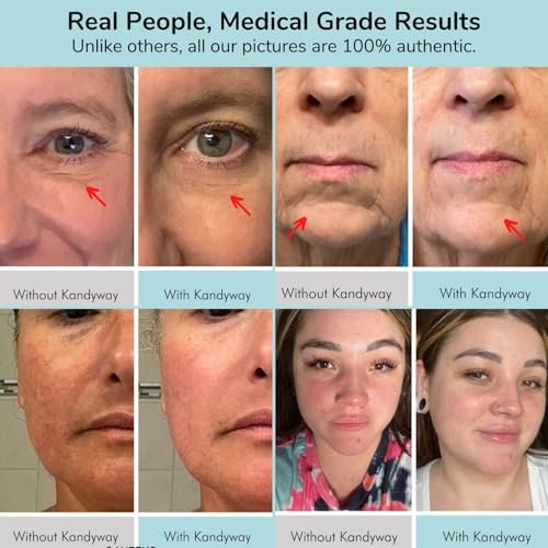 Pro LED Skincare Mask: FDA Cleared Anti-Aging Red Light Therapy Device - Image 3