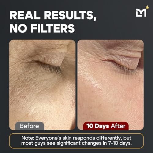 Ultimate Anti-Aging Skincare Kit for Men: Vitamin C, Dark Circle Reducer - Image 6