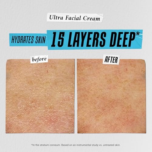 Kiehl's Dry Skin Rescue Set: Hydrating Moisturizer + Eye Cream Kit - Image 4