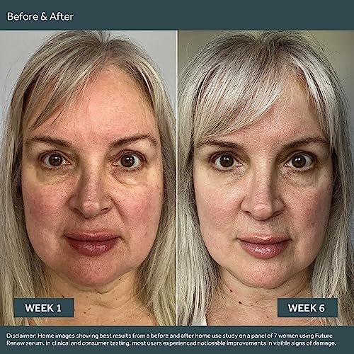 No7 Anti-Aging Skincare Set: Damage Reversal Serum, Day & Night Creams SPF25 - Image 8