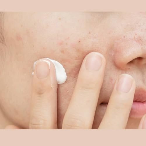 Clear Skin Daily Moisturizer | Acne Treatment & Oil Control | M.A.D Skincare - Image 2