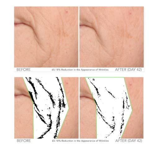 Here's a rewritten, SEO-friendly product title:
Serious Skincare Vitamin C Serum: Bright Glow Anti-Aging Face Treatment - Image 4