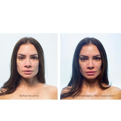 Ultimate Skincare Set: 6-Step Anti-Aging Hydrating Routine for Radiant Skin - Image 9