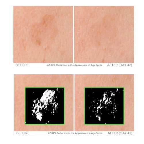 Here's a rewritten, SEO-friendly product title:
Serious Skincare Vitamin C Serum: Bright Glow Anti-Aging Face Treatment - Image 3