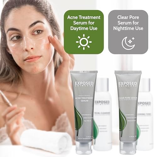 Clear Acne Naturally: Exposed Skin Care Kit with Salicylic Acid & Benzoyl Peroxide - Image 8