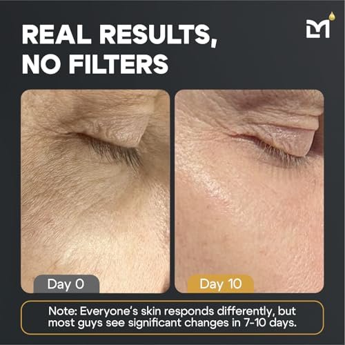 Mens Anti-Aging Skincare Kit: Dark Circle Reducer, Wrinkle Defense Serum - Image 6