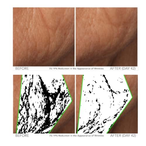 Here's a rewritten, SEO-friendly product title:
Serious Skincare Vitamin C Serum: Bright Glow Anti-Aging Face Treatment - Image 6