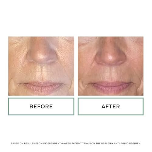 Here's an SEO-friendly, engaging title within 70 characters:
Replenix Age Restore Anti-Aging Night Cream for Mature Skin - Image 5