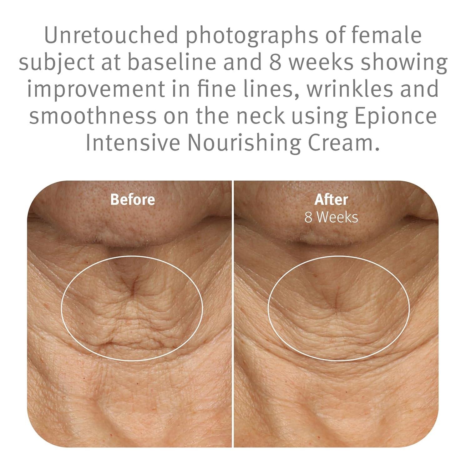 Epionce Intensive Nourishing cream: Worth It for Dry Skin?