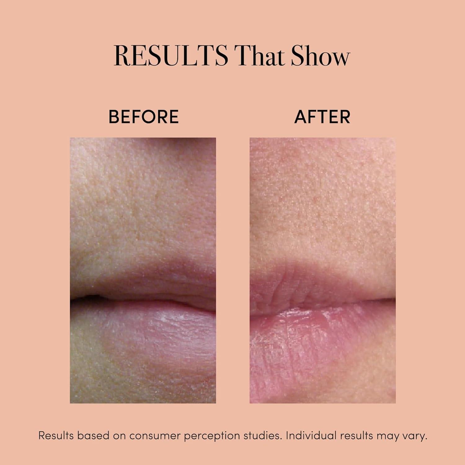 ReVive Lux Lip Plumper Review: ⁤Right for Dry Lips?