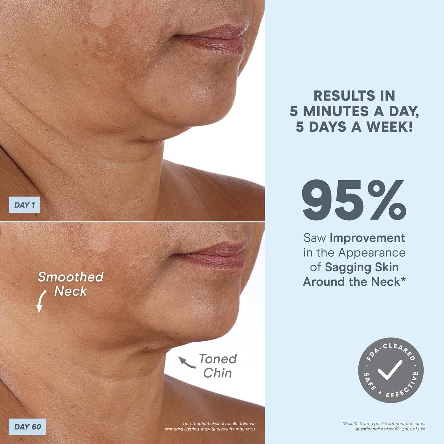 nuface MINI+ Review: Does Microcurrent Really Lift?