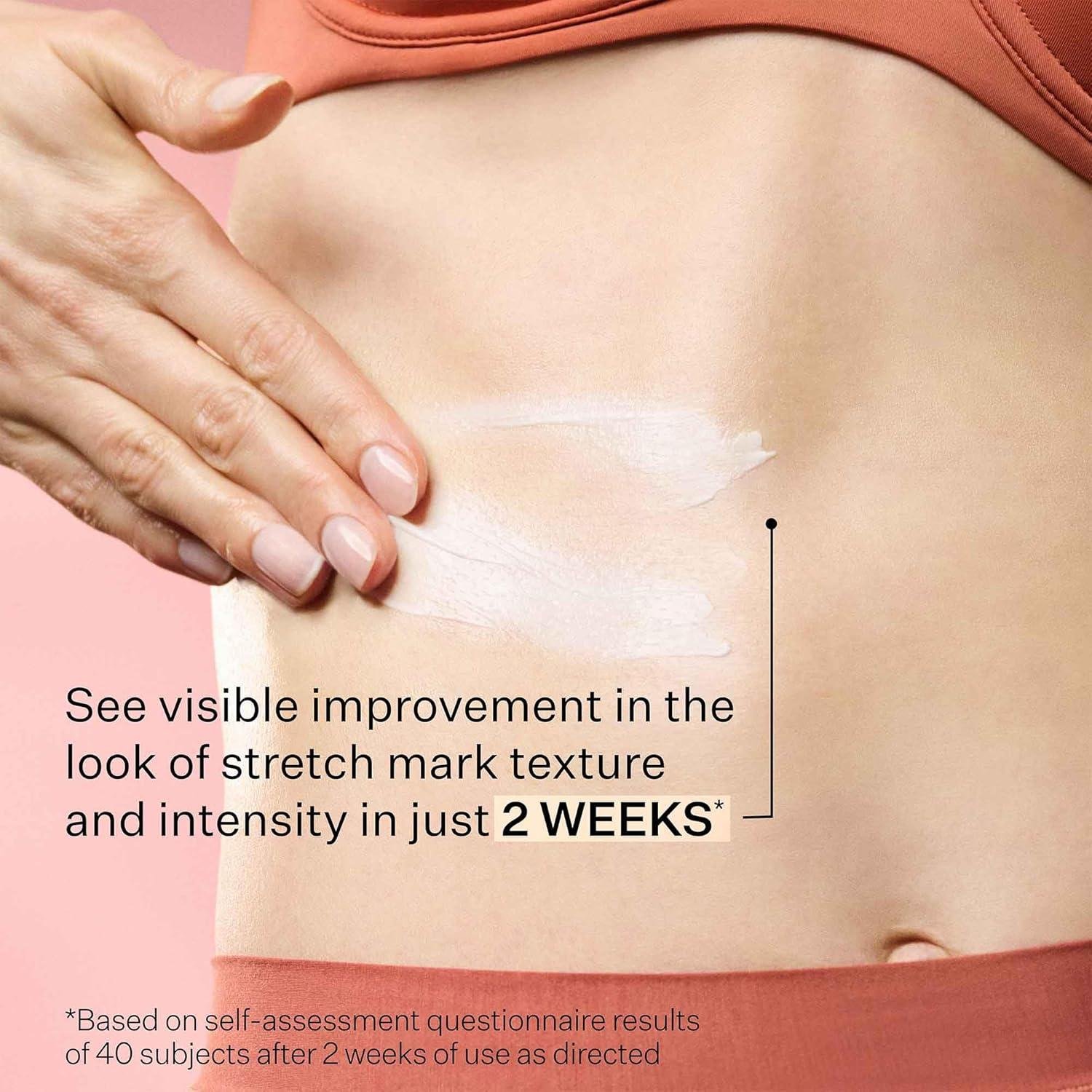 StriVectin SD Advanced Plus Review: Does it Work for wrinkles?