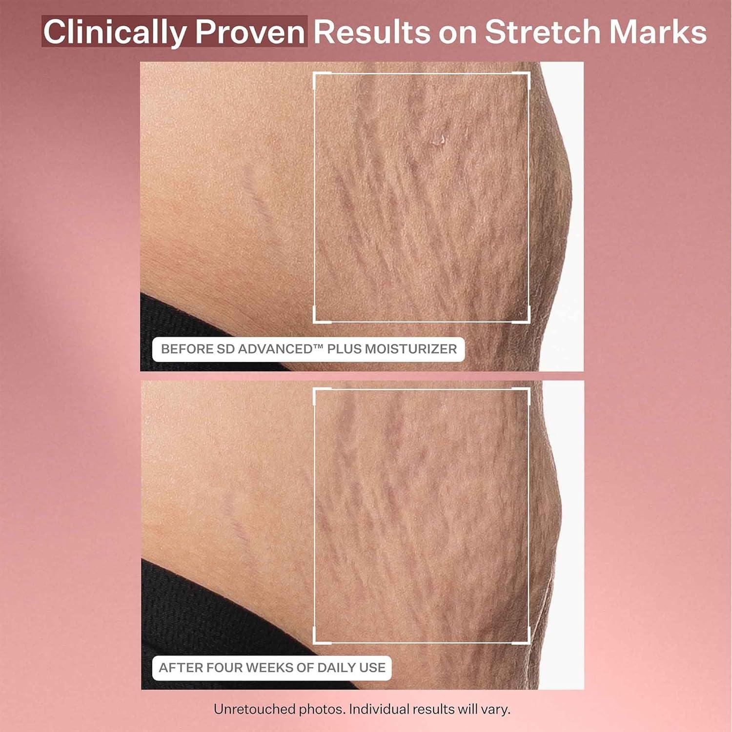 StriVectin SD Advanced Plus Review: Does It Work for Wrinkles?