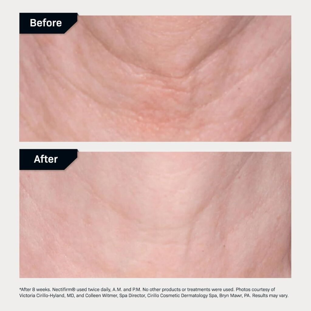 Nectifirm Neck Cream Review: Does It Firm & Lift?