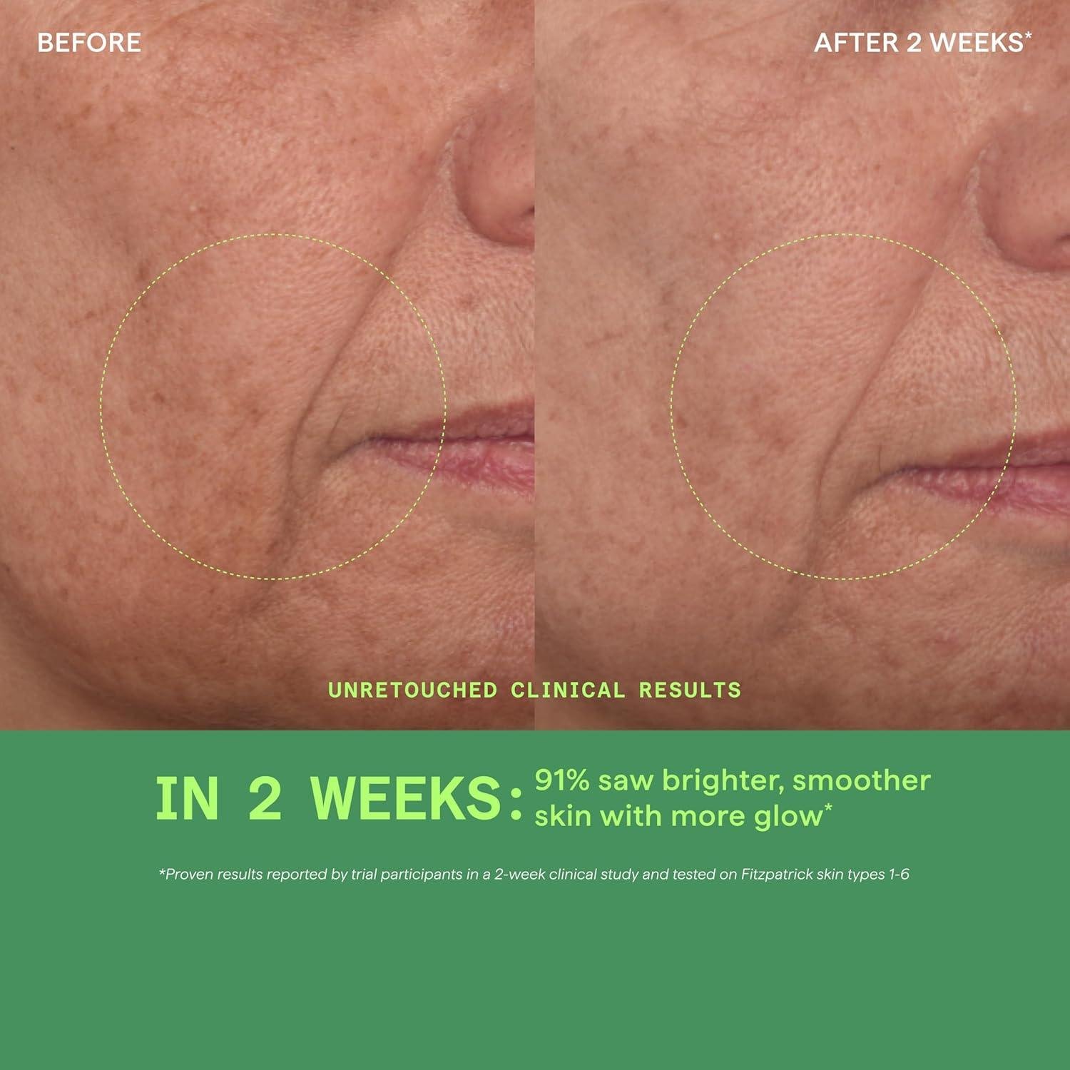 Murad Vita-C Glycolic Serum Review: Worth the Hype?