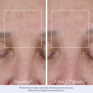 Obagi ELASTIderm Review: Does It Firm Mature Skin?