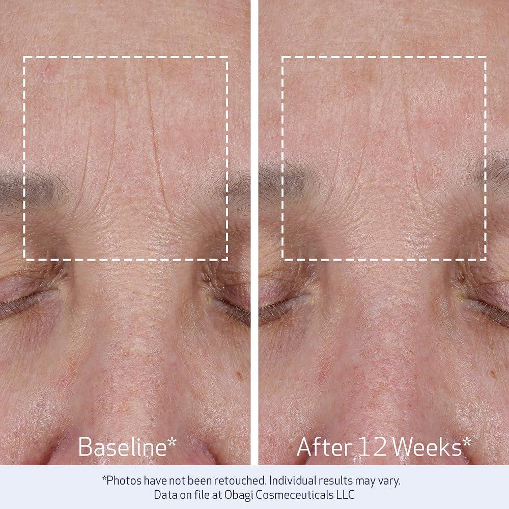 Obagi ELASTIderm Review: Does It Firm Mature Skin?