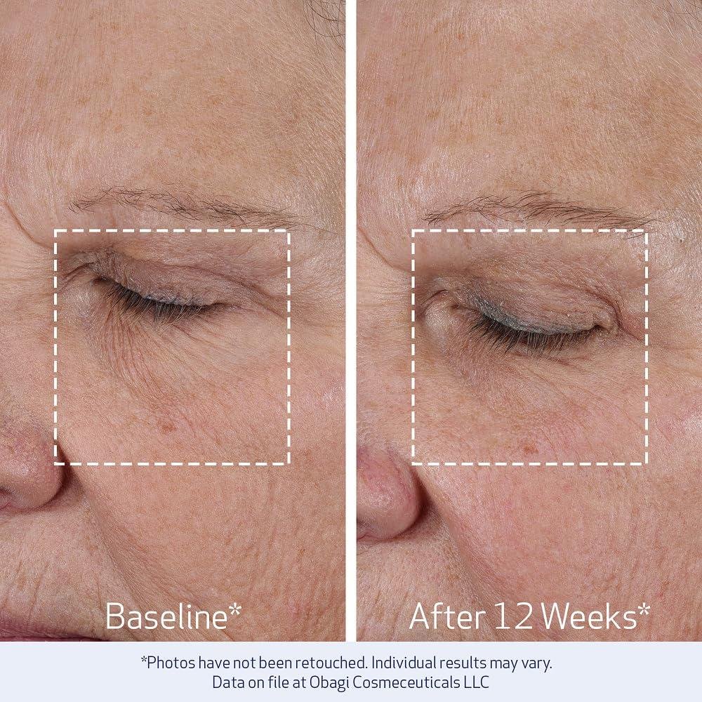 Obagi ELASTIderm Review: Does It Firm Mature Skin?
