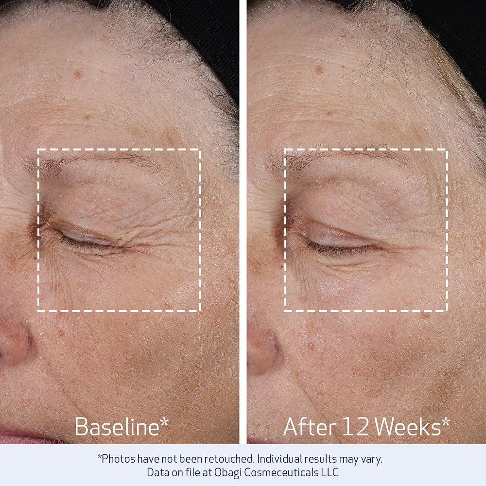 Obagi ELASTIderm Review: Does It Firm Mature Skin?