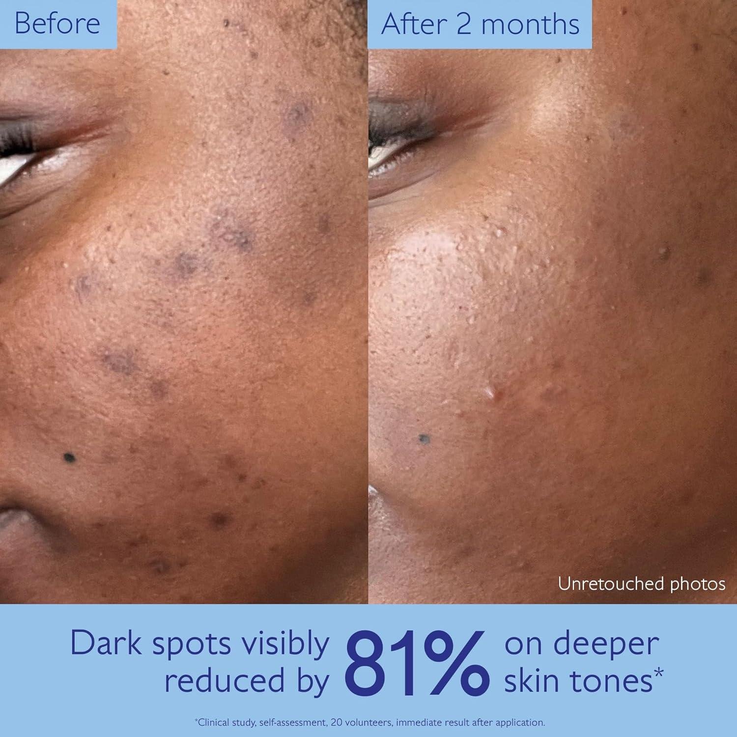Caudalie vinoperfect Review: Does It Work for Dark Spots?