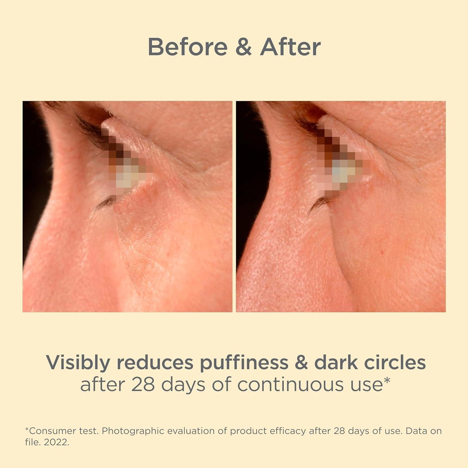 ISDIN K-Ox Eyes Review: does It Work for Dark Circles?
